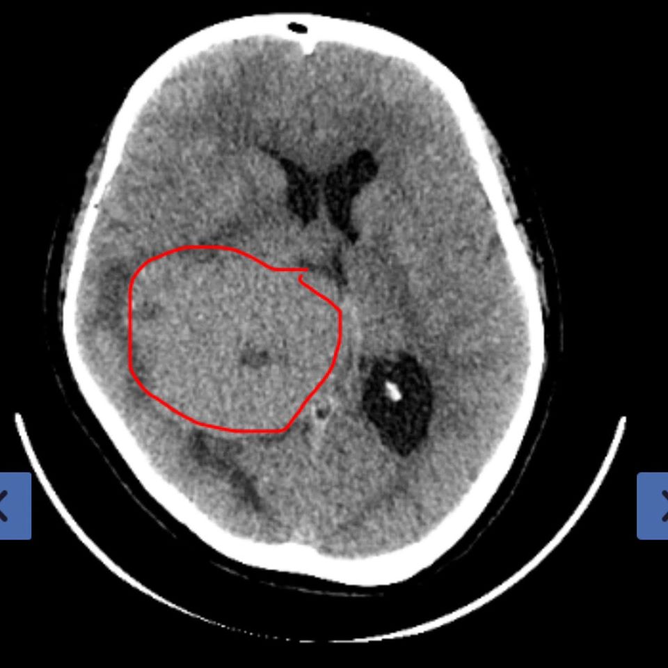 Public hospital neurosurgeon target of complaint for misconduct towards ...